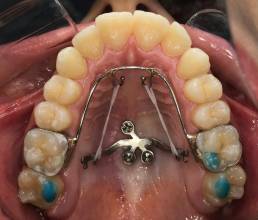 ortodontia biocriativa