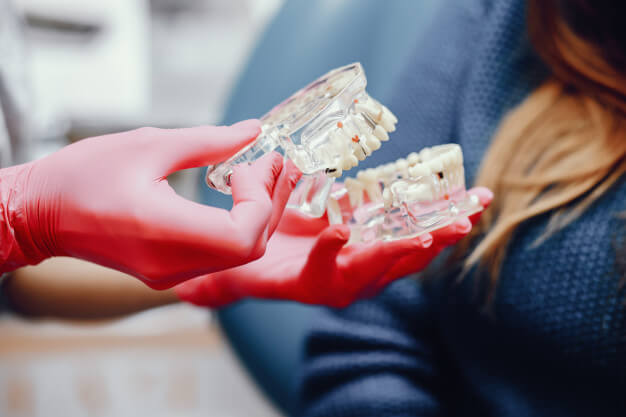 dentista mostrando mini implante