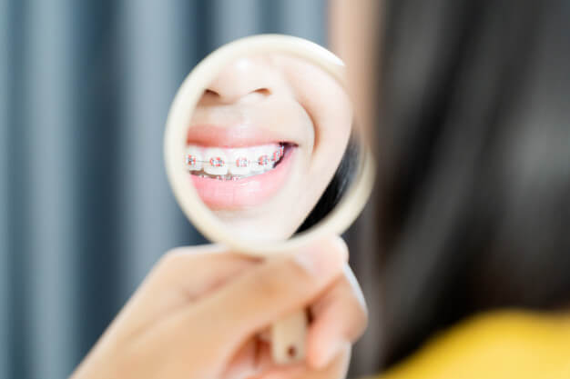 ortodontia estética paciente olhando no espelho