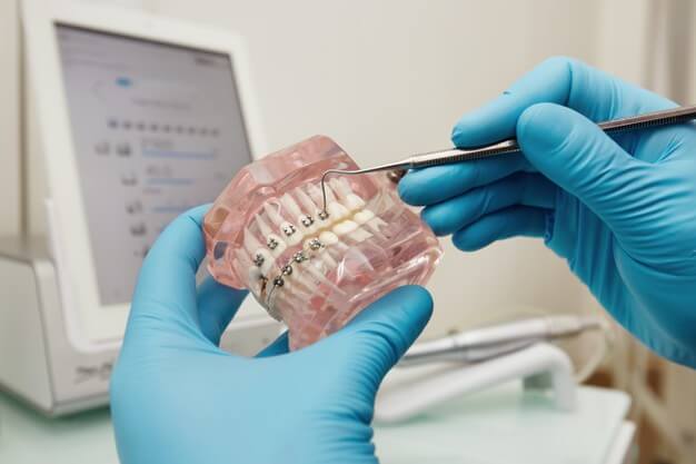 dentista mostrando aparelho metálico