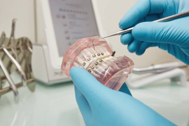 dentista mostrando aparelho autoligado