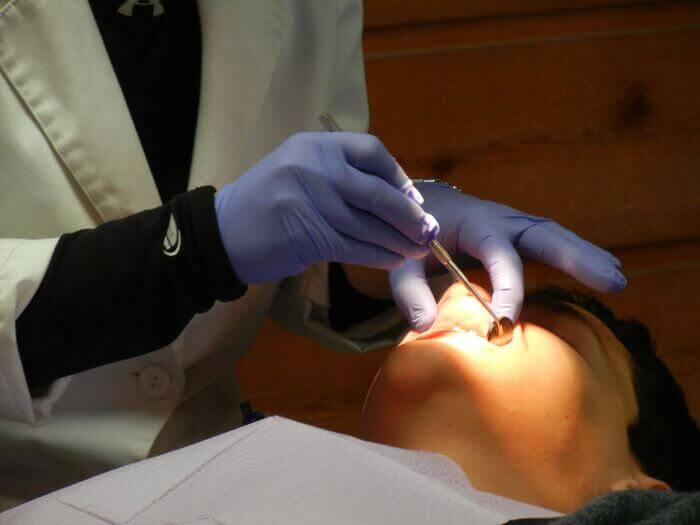 tipos de clareamento dental limpeza