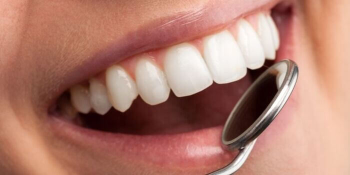 placa bacteriana evidenciador de placa bacteriana