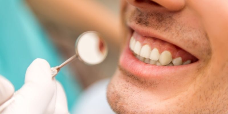  periodontia canal e periodontia