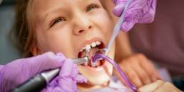 restauraçãoo dentária criança no dentista